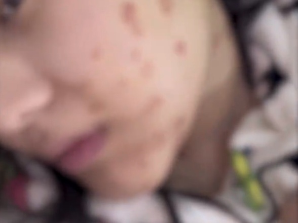 江苏连云港一女生生日惊喜变噩梦;买猫后感染猫藓,维权遇冷处理。 健康养生