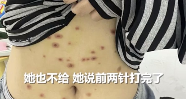 江苏连云港一女生生日惊喜变噩梦;买猫后感染猫藓,维权遇冷处理。 健康养生