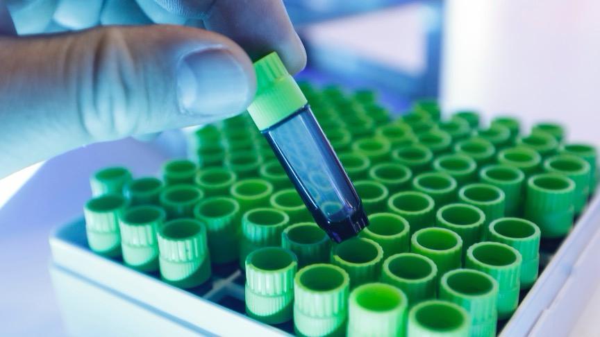  技术深挖：GZR33注射液Ⅲ期临床背后的药理学突破与长效控糖新范式 新闻